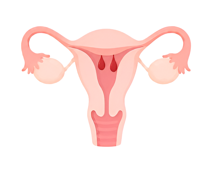 4-polype uterin-1