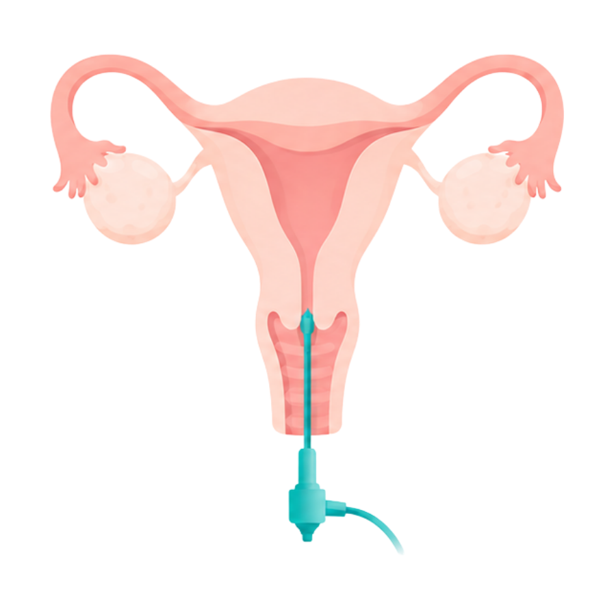 Hysteroscopy Slider