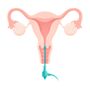 Hysteroscopy