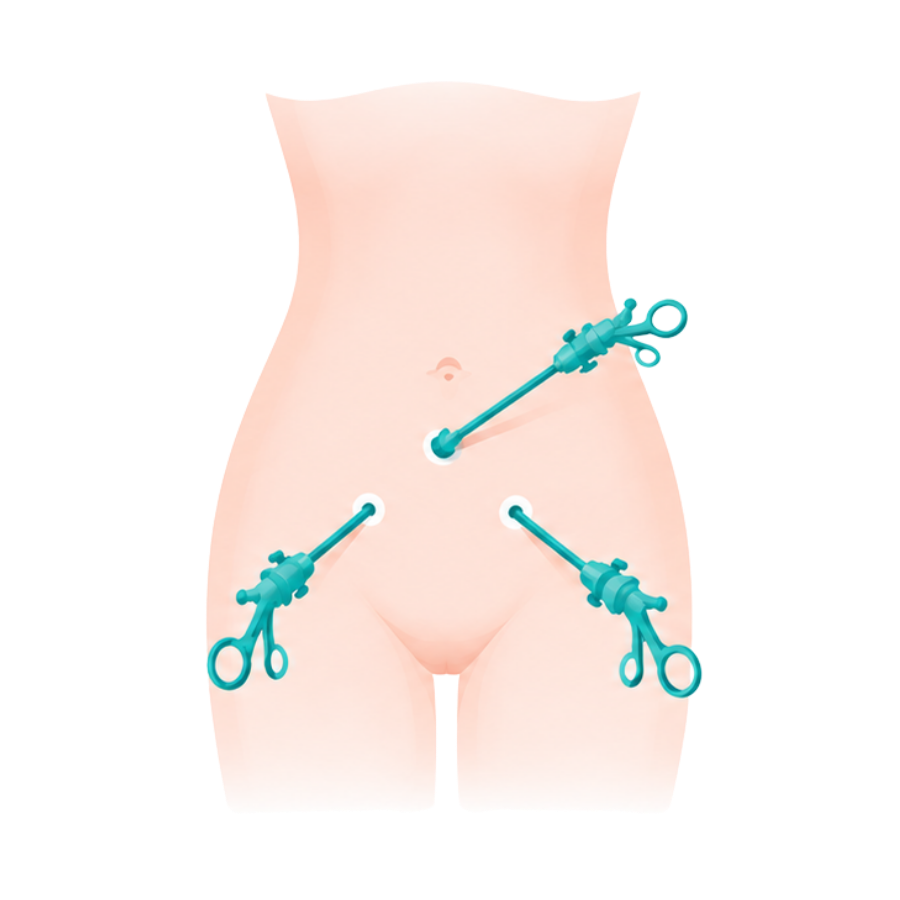 Laparoscopy Slider