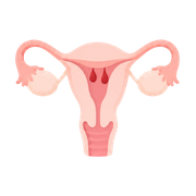 Uterine polyp
